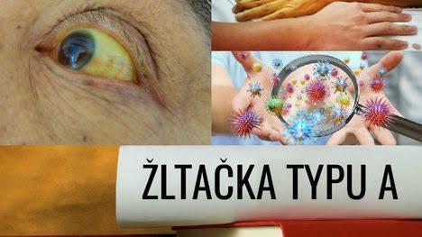 ŽLTAČKA